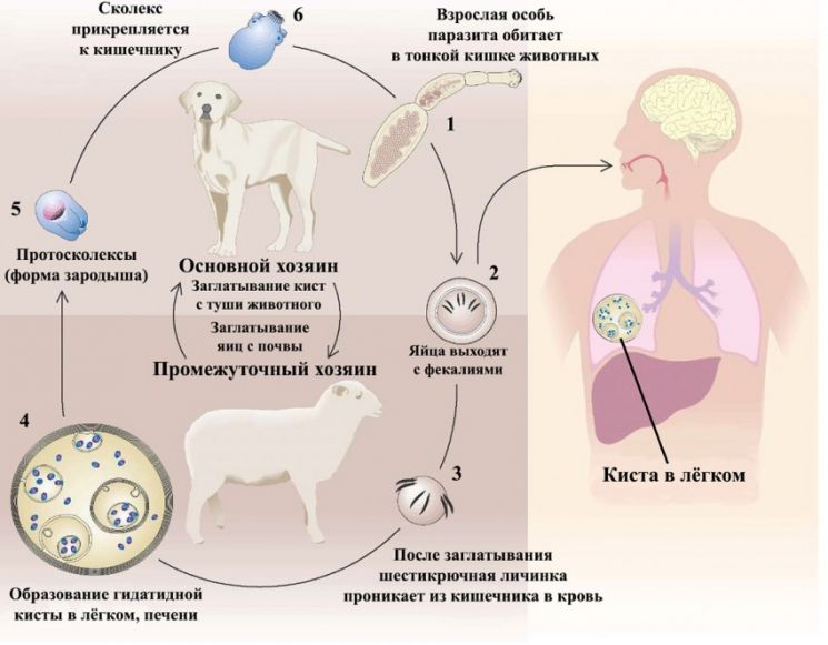 Эхинококкоз (лат. Echinococcosis) &mdash; гельминтоз из группы цестодозов